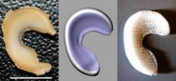 The future of sports injuries: 3D-printed implants could let you play again