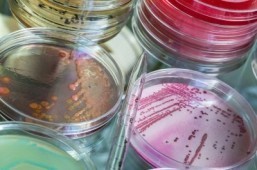 Modified strain of gut bacteria could be used to combat obesity